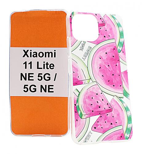 TPU Designdeksel Xiaomi 11 Lite NE 5G / 11 Lite 5G NE