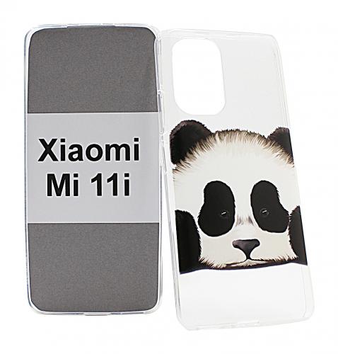 TPU Designdeksel Xiaomi Mi 11i