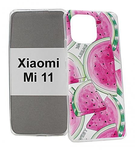 TPU Designdeksel Xiaomi Mi 11