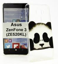 TPU Designdeksel Asus ZenFone 3 (ZE520KL)