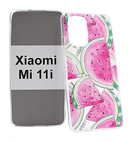 TPU Designdeksel Xiaomi Mi 11i