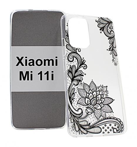 TPU Designdeksel Xiaomi Mi 11i