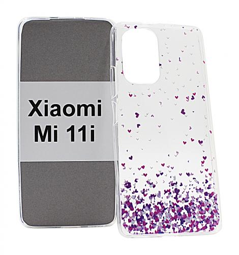 TPU Designdeksel Xiaomi Mi 11i