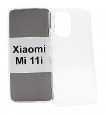TPU-deksel for Xiaomi Mi 11i