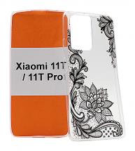 TPU Designdeksel Xiaomi 11T / 11T Pro