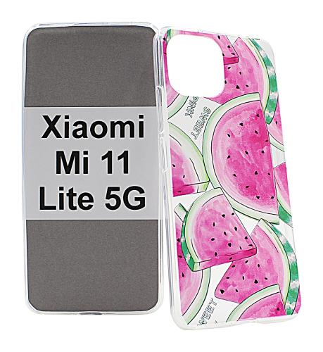 TPU Designdeksel Xiaomi Mi 11 Lite / Mi 11 Lite 5G