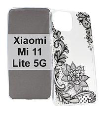 TPU Designdeksel Xiaomi Mi 11 Lite / Mi 11 Lite 5G