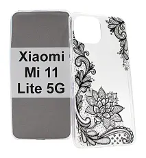 TPU Designdeksel Xiaomi Mi 11 Lite / Mi 11 Lite 5G