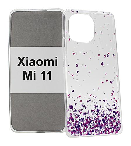 TPU Designdeksel Xiaomi Mi 11