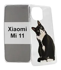 TPU Designdeksel Xiaomi Mi 11