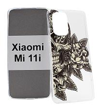 TPU Designdeksel Xiaomi Mi 11i