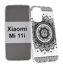 TPU Designdeksel Xiaomi Mi 11i