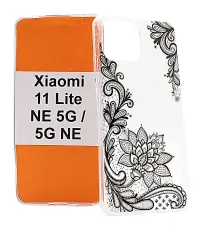 TPU Designdeksel Xiaomi 11 Lite NE 5G / 11 Lite 5G NE