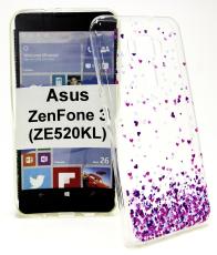 TPU Designdeksel Asus ZenFone 3 (ZE520KL)